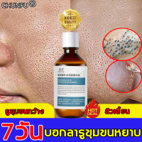 บอกลารูขุมขนหยาบ CHUNFU เซรั่มบำรุงผิวหน้า 220ml ผิวชุ่มชื้นกระชับรูขุมขนกว้างและฟื้นฟูผิวชุ่มชื้นและเงางาม เซรั่มลดรูขุมขน เซรั่มหน้าใส เซรั่มบำรุงผิว เซรั่มหน้าใสไว เอสเซนส์บำรุงผิวหน้า เซรั่มกระชับรูขุมขน เซรั่มรูขุมขน เซรั่มทาใบหน้า บำรุงผิวหน้าเซรั่ม