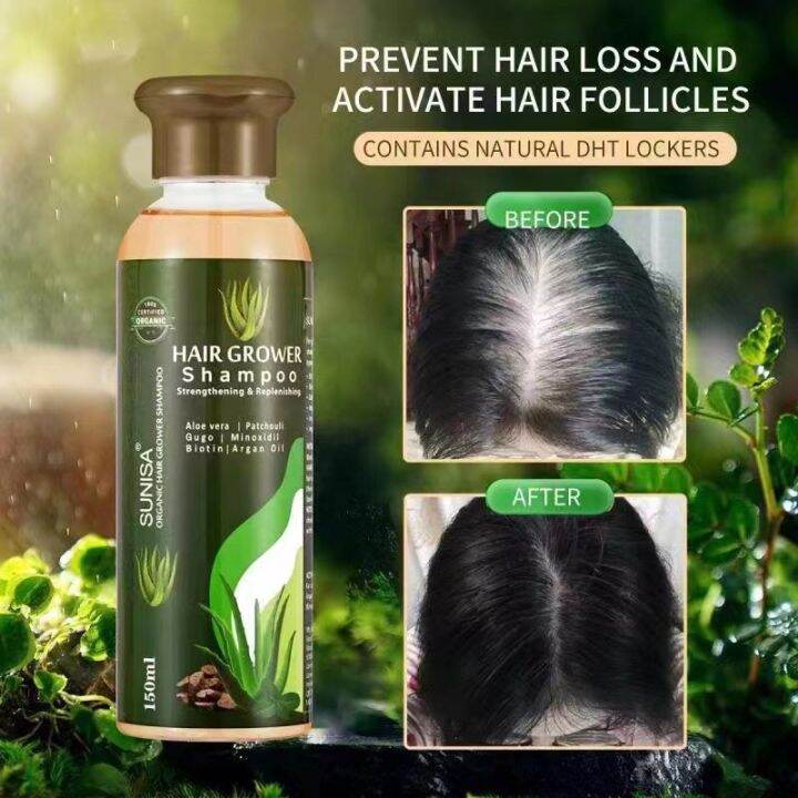 Extreme Hair Grower Shampoo 150ml sunisa | Lazada PH