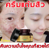 XUEROUYAR ครีมกำจัดสิว 30g แก้ปัญหาสิวต่างๆรวดเร็วด้วยสมุนไพรอ่อนโยน คุณรู้ไหมว่าคุณจะสวยแค่ไหนโดยไม่มีสิว? ดูดซึมเร็ว ได้ผลชัดเจน ลดรอยแผลเป็นจากสิว คืนผิวสวยกลับมา