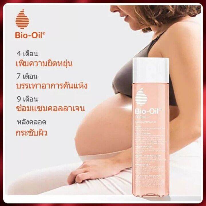 รอยแตกลายเป็นมา-10-ปีก็หายได้-bio-oil-ครีมลดรอยแตกลาย-สาระสำคัญของพืชหลายชนิด-ท้องเรียบเนียนละเอียดอีกครั้ง-ครีมทาหน้าท้อง-โลชั่นท้องลาย-ลบรอยแตกลาย-ครีมลดรอยแตกลาย-ครีมทาท้อง-ท้องลาย-ลดรอยแตกลาย-รอยแ