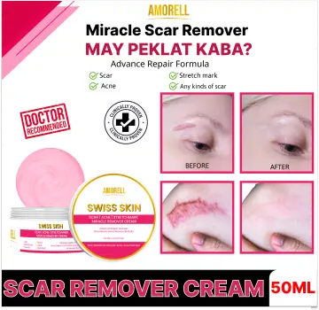 Shop Miracle Organic Mole Remover with great discounts and prices