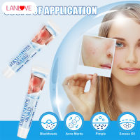 LANLOVE Acne Repair Cream Multipurpose Pimple Blackhead Removal Cream Professional Facial Care Supplies