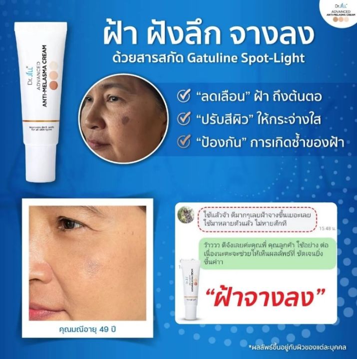 ครีมลดเลือน-ฝ้า-กระ-จุดด่างดำ-dr-jill-advanced-anti-melasma