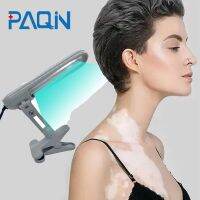 Paqin Certificate Led Vitiligo Uvb Phototherapy Narrow 311Nm Uv Phototherapy Lamp Uvb Light Therapy Psoriasis For Vitiligo