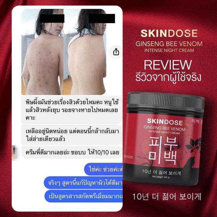 skindose-โสมพิษผึ้งจักรพรรดิ-ครีมโสม-ครีมโสมพิษผึ้ง