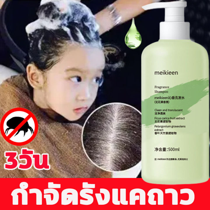 oushila-ไรฝุ่น-ยาสระผมเชื้อรา-500ml-แชมพูขจัดรังแค-ผมเรียบ-บรรเทาอาการคันหนังศีรษะ-แชมพูมะเดื่อ-แชมพูสมุนไพรยาสระผม-ยาสระผมรังแค-แชมพูแก้เชื้อรา-แชมพูรักษารังแค-ยาสระผมขจัดรังแค-ดูแลหนังศีรษะ-ยาสระผมแ