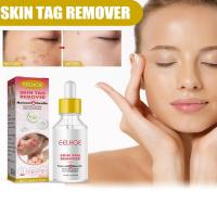 30ml Skin Tag Remover Serum Natural Advanced Skin Care Tag Serum Skin Corrector P7W7