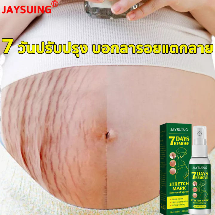 พร้อมส่ง-ใช้ได้ทั้งรอยแตกลายใหม่และเก่า-ครีมรอยแตกลาย-ครีมลอยแตกลาย-ครีมทาแตกลาย-ครีมแก้แตกลาย-ครีมทาท้องลาย-ครีมทาขาแตกลาย-ครีมลดรอยแตก-ครีมทารอยแตกลาย