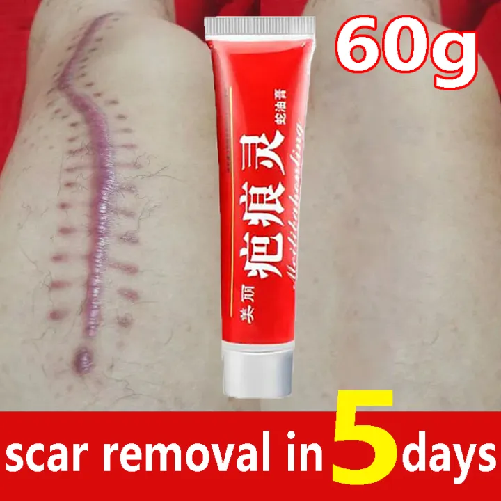 【Doctor Scar Remover Gel 60 g Serum Cream Scars Repair