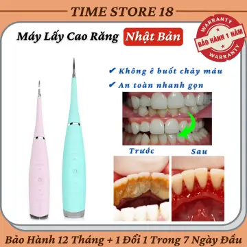 Có những chế độ nào trên máy lấy cao răng siêu âm?
