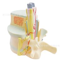 3308 spinal cord and spinal cord and spinal vertebrae model zoom model dissection medical teaching model