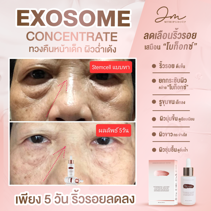 jolasma-contour-serum-โจลาสม่าเซรั่มสเต็มเซลล์แบบทา-หน้าเด็ก-ย้อน-วัย-ของแท้จากบริษัท