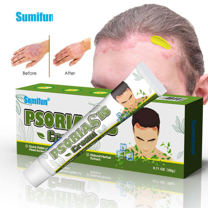 Psoriasis Shu Emulsifiable Paste Forehead Hair Body Fat Care Cream