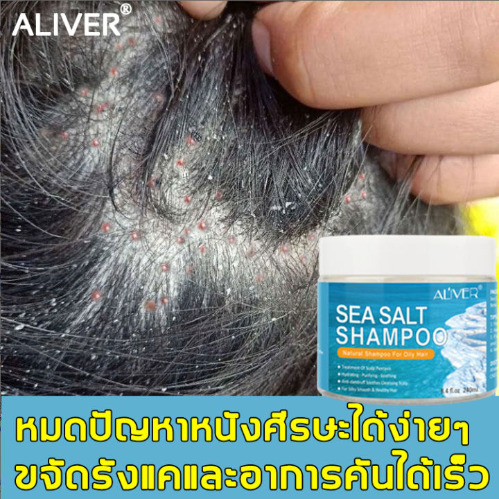 หมดปัญหาหนังศีรษะ】Aliver ยาขจัดรังแค ป้องกันรังแค ป้องกันคัน แก้ผมชี้ฟู  ทำความสะอาดล้ำลึก เหมาะสำหรับรังแค（ยาสระผมแก้เชื้อรา ยาสระผมเชื้อรา  แชมพูสระผมขจัดรังแค แชมพูรักษารังแค ยาสระผมรังแค สระผมรังแค） | Lazada.Co.Th