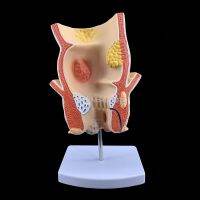 Brand New Anatomical Human Rectum Pathology Lesion Model Hemorrhoids Anus Medical Teaching Supplies