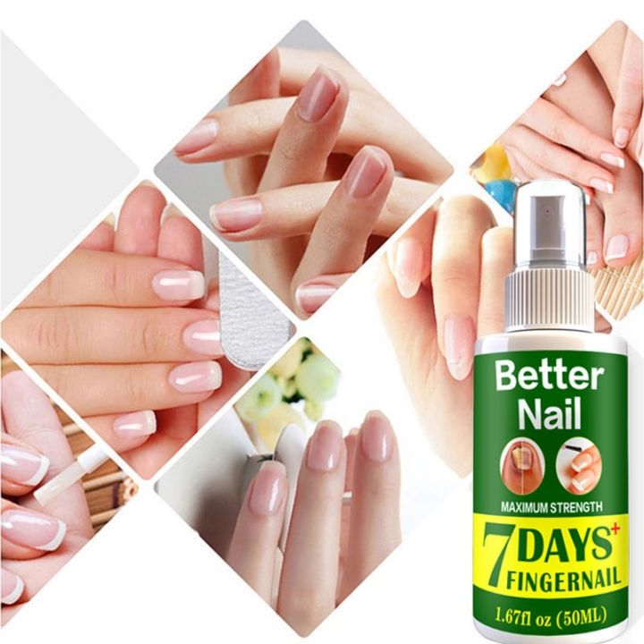 fungal-nail-repair-spray-nursing-treatment-foot-nail-fungus-removal-gel-anti-infective-paronychia-onychomycosis-care