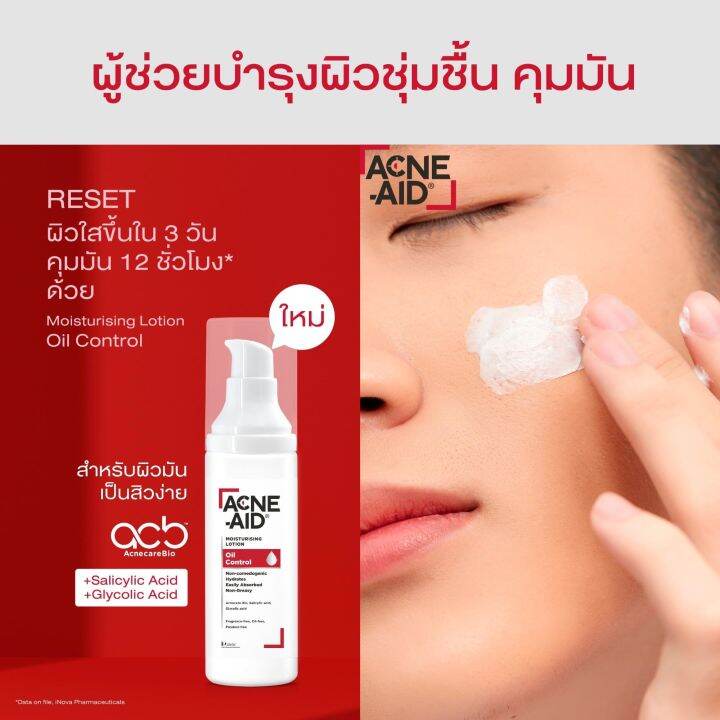 acne-aid-moisturising-lotion-oil-control-แอคเน่-เอด-มอยซ์เจอร์ไรซิ่ง-โลชั่น-ออยล์-คอนโทรล-30-ml