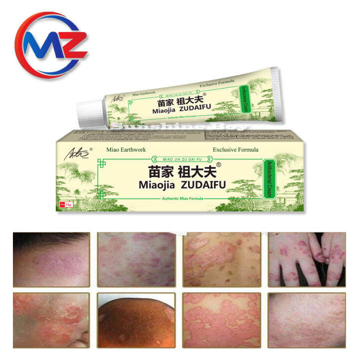 Arturo 15g zudaifu Natural Chinese Herb Herbal Medicine Psoriasis ...