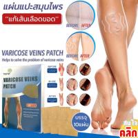 varicose veins patch แผ่นแปะสมุนไพรแก้เส้นเลือดขอด