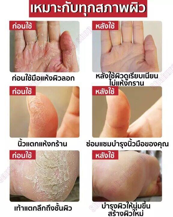 ผู้ขายในท้องถิ่น-laikouครีมน้ำมันแกะ-ครีมน้ำมันแกะลาโนลินออสเตรเลียสูตรเข้มข้น-ช่วยให้ผิวเนียนนุ่ม-เด้งฟู-หน้าขาวใส-ควบคุมน้ำมัน-ขัดขี้ไคล-ครีมลาโนลิน-ครีมหน้าขาวใส-มอยส์เจอร์ครีม-ป้องกันรอยแตกเท้า-คร