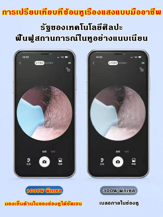 ความละเอียดสูง-weilan-ที่แคะหูกล้อง-usb-การเชื่อมโยงwifi-ถ่ายภาพ-วิดีโอได้เอง-พร้อมเครื่องทําความสะอาดหูกล้องขนาดเล็กสําหรับโทรศัพท์และคอมพิวเตอร์-แคะหู-กล้อง-ไม่แคะหูกล้อง-ที่แคะหู-กล้องส่องแคะหู-ไม้