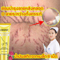 สูตรธรรมชาติบริสุทธิ์ OEDO ครีมท้องแตกลาย เป็นคุณแม่ดูเซ็กซี่ไร้รอยแตกลาย! (ครีมทาท้องลาย ครีมแก้ท้องลาย ครีมหน้าท้องแตกลาย ลดผิวแตกลาย ครีมทาหน้าท้อง โลชั่นท้องลาย ลบรอยแตกลาย ครีมลดรอยแตกลาย ครีมทาท้อง ท้องลาย ลดรอยแตกลาย รอยแตกลาย แก้รอยแตกลาย)