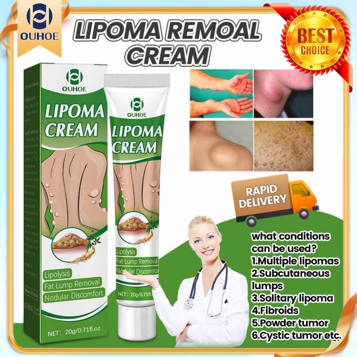 Lipoma Remover Lipoma Removal Cream original lipoma ointment japan ...