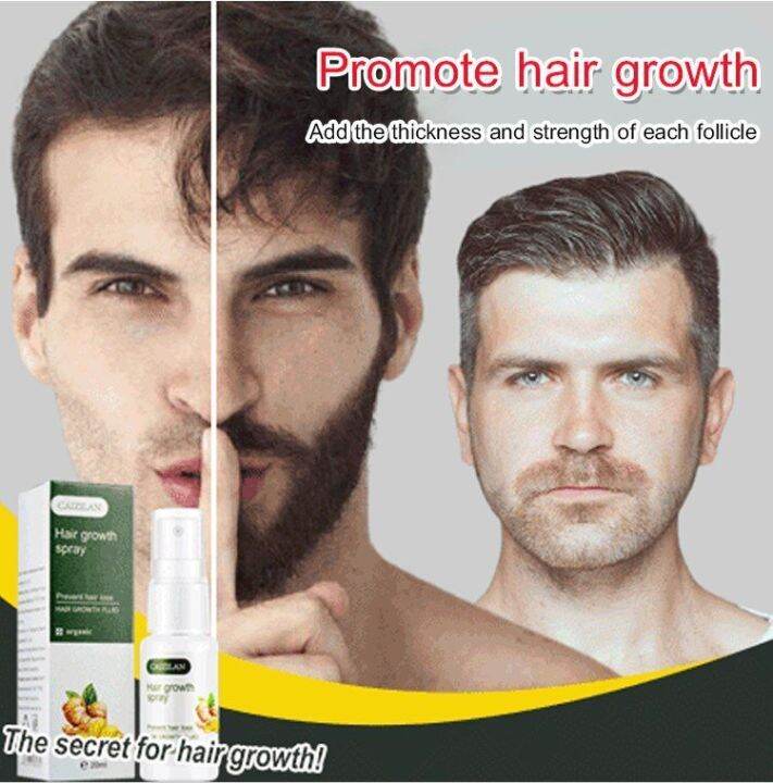 coolrich Ginger Hair Growth Spray Lazada