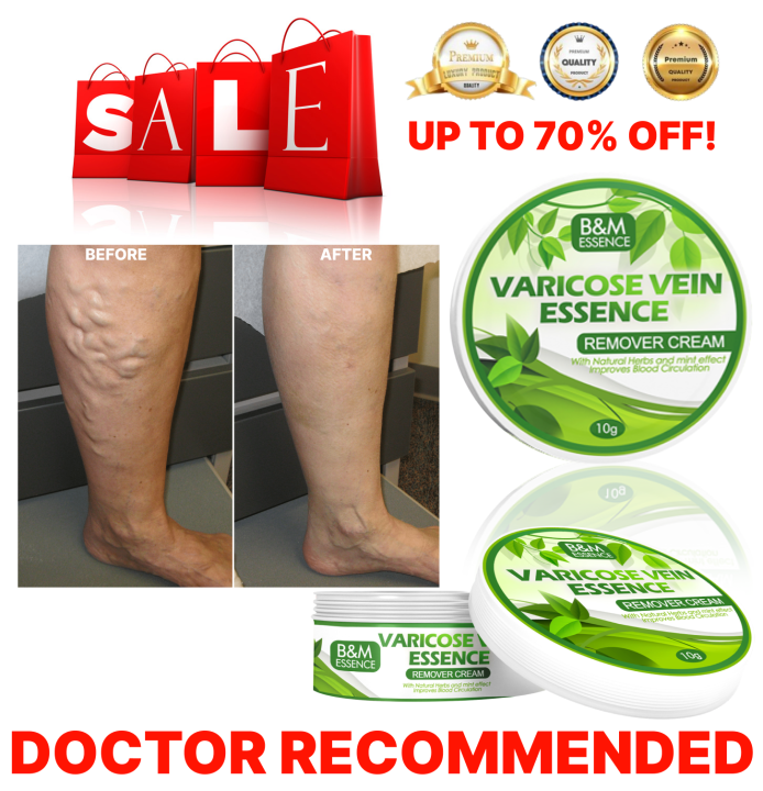 🔥 HOT SALE🔥 THE BEST VARICOSE VEIN CREAM EVER! Best Seller B&M Essence