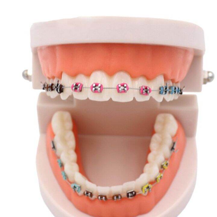 1pc Dental Orthodontic Treatment Model With Ortho Metal Bracket Arch