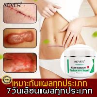 ALIVER ครีมลดรอยแผลเป็น 50ml แผลไฟไหม้ ครีมทาผิว รอยแตกลาย รอยแผลเป็นต่างๆ ช่วยให้แผลเป็นจางหายอย่างมีประสิทธิภาพ ครีมบำรุงหน้า