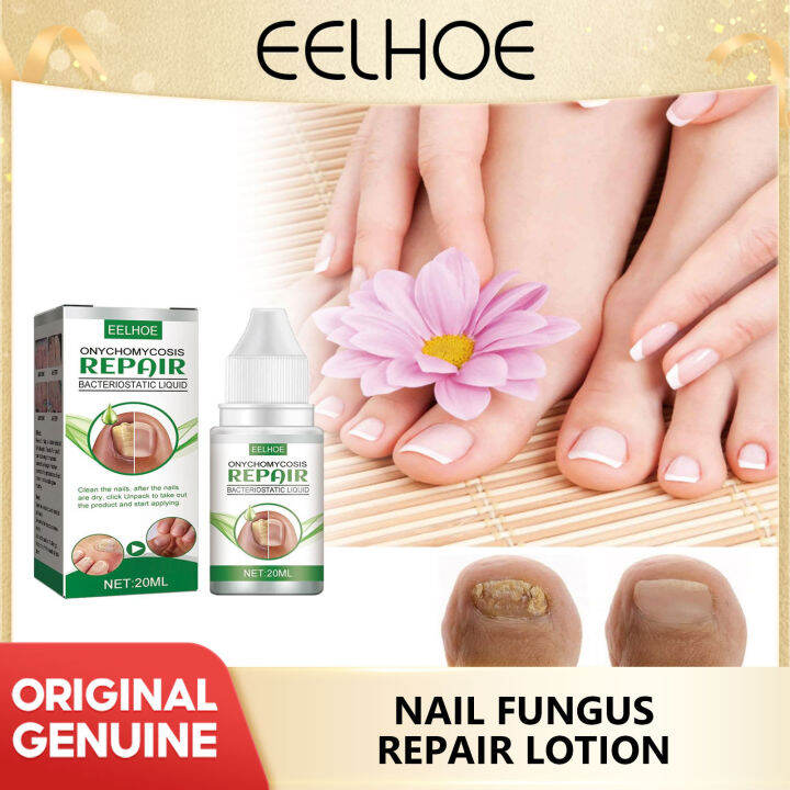 Eelhoe Grey Nail Repair Liquid Thickening Type Grey Nail Repair Liquid