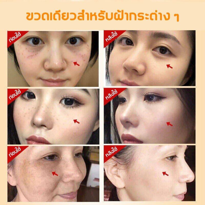 ครีมลดฝ้ากระ-ครีมแก้ฝ้าหนาๆ-คีมทาฝ้า-eelhoe-ครีม-แก้-ฝ้า-กระ-ทาฝ้าของแท้-vitamin-c-ของแท้