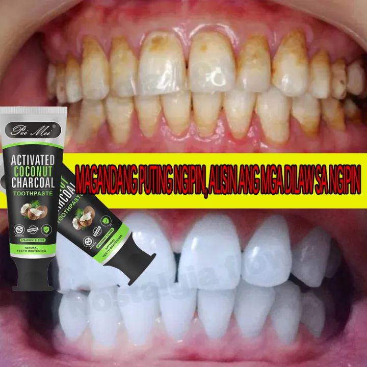 PEIMEI Whitening Toothpaste Activated Coconut Charcoal Toothpaste Hygiene Cleaning Fresh Breath