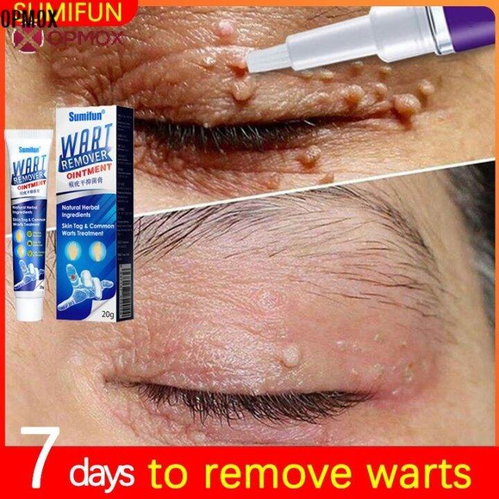 PRB273 100 All Natural and Organic Scar Care Ointment Original 20g