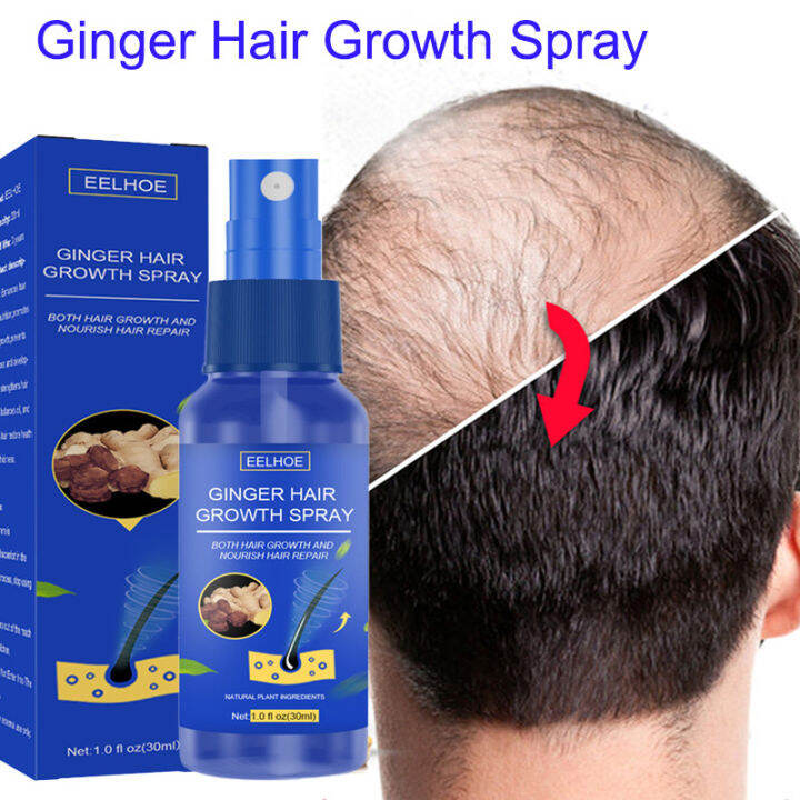 EELHOE Hair Growth Spray Promotes Hair Growth Hair Growth Spray Ginger Extract Prevent Baldness