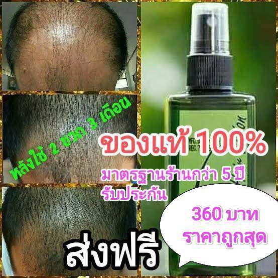 ของแท้-โปรโมชั่น-2-แถม-1-neo-hair-lotion-แถมฟรี-roller-ส่งด่วนทุกวัน-ของแท้-100-นีโอแฮร์โลชั่น-neohair-ส่งตรงจากโรงงาน