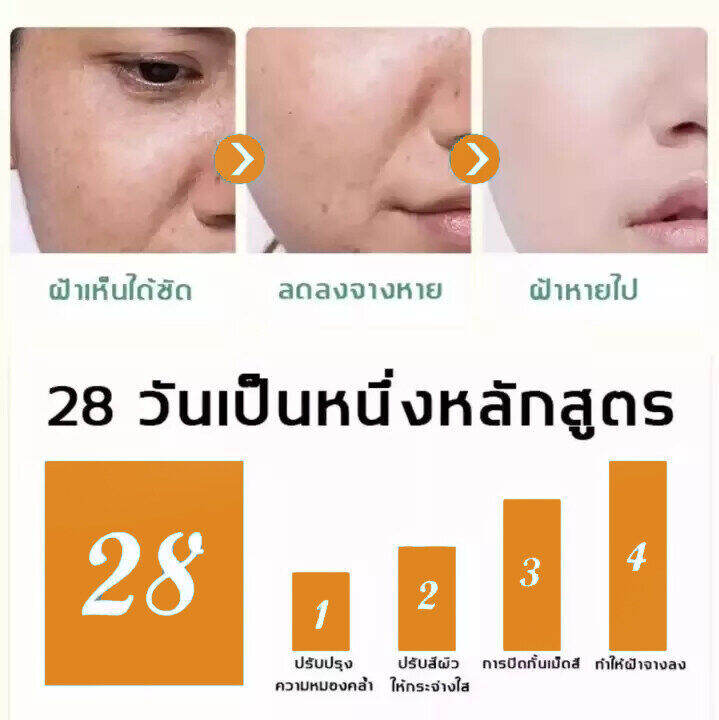 ครีม-แก้-ฝ้า-กระ-eelhoe-vitamin-c-ครีมทาฝ้า-ครีมแก้ฝ้าแท้ๆ-ครีมทาฝ้าหนาๆๆ-ครีมแก้ฝ้าถาวร-ครัมทาฝ้ากระ-กำจั-จุดด่างดำ-กระ-ให้ผิวขาวขึ้-ให้ความชุ่มชื้นต่อต้านริ้วรอย-whitening-freckle-cream