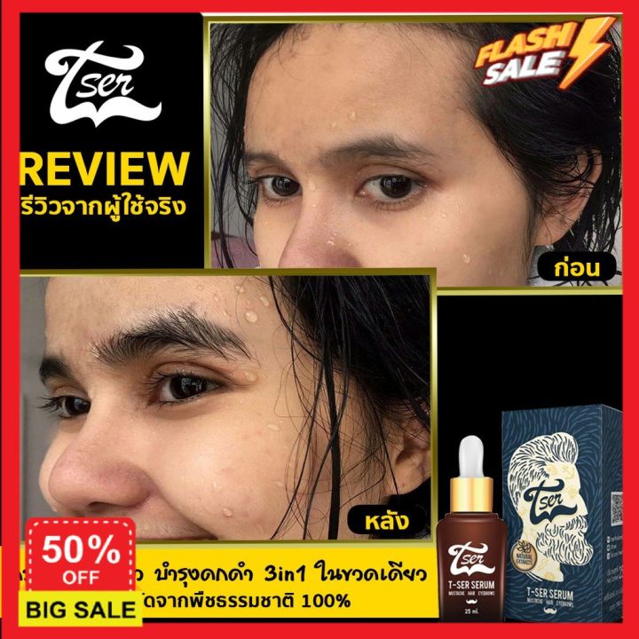 hair-treatments-เซรั่มบำรุงผม-ครีมนวดผม-ทรีสเมนบำรุงผม-ทรีทเมนท์-ปลูกผม-t-ser-น้ำยาปลูกผม-ปลูกไรผม-ดก-ที่ปลูกผมขึ้นจริง-3ขวด-เคราตินบำรุงผม-บำรุงผม-ดูแลผม-ดูแลเส้นผมเสีย