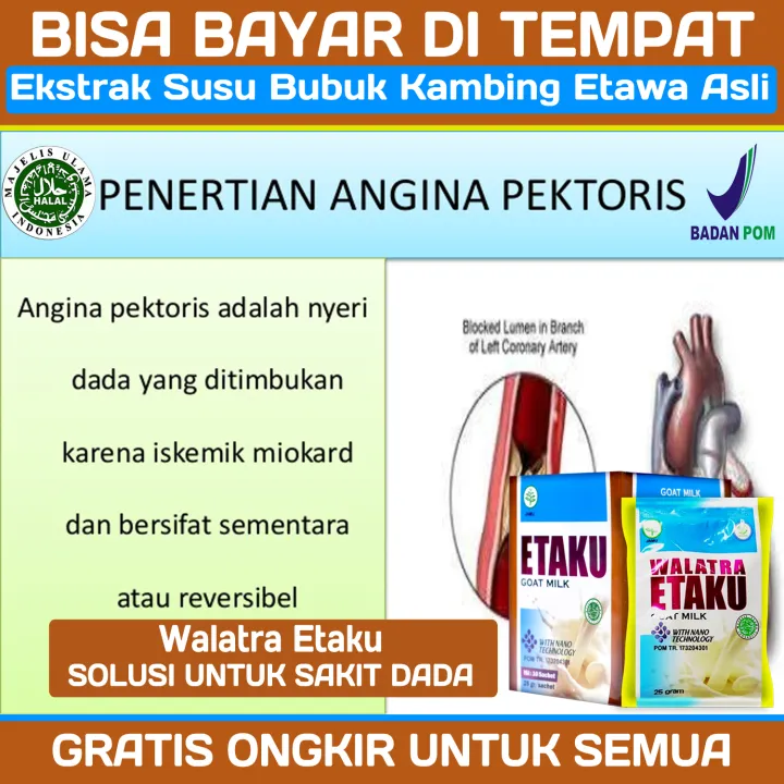 Obat Sakit Dada Sebelah Kiri Obat Nyeri Dada Susu Obat Angina Pektoris ...