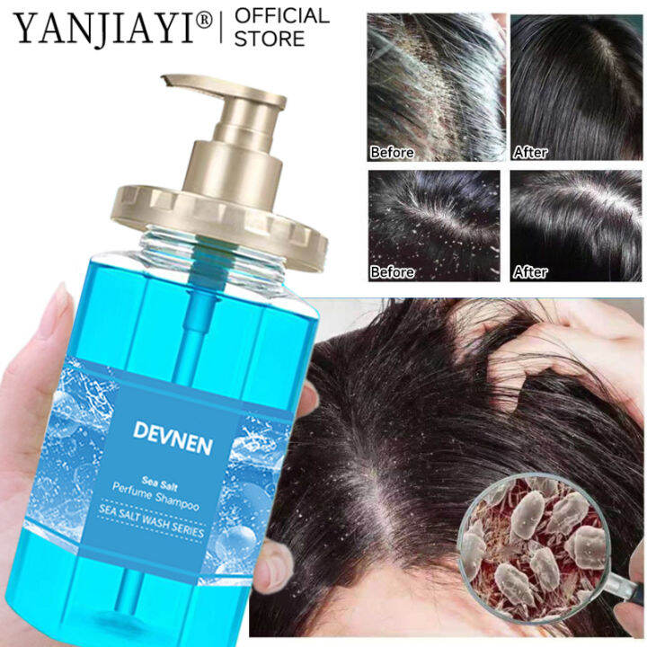 YANJIAYI 500ML Sea Salt Anti Dandruff Shampoo for Scalp Itching and Dandruff for Men & Women