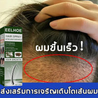 ?บอกลาหัวล้าน?สเปรย์ปลูกผม เร่งผมขึ้นใหม่ เร่งผมยาวไว ป้องกันผมร่วง ป้องกันผมร่วงอย่างมืออาชีพ แก้ปัญหาผมร่วง ลดผมร่วง(น้ำยาใส่ผม ยาปลูกผม น้ำยาปลูกผม น้ำยาเร่งผมยาว เซรั่มปลูกผม ปลูกผมเร่งด่วน ปลูกผม ยาปลูกผมของแท้ ยาปลูกผมผู้ชาย)Hair Growth