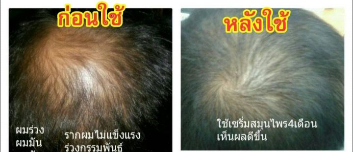 จินดา-เซรั่ม-ใบหมี่สด-อัญชัน-สูตรโบราณ-120-มล-บำรุงเส้นผม-เสริมสร้างรากผมให้แข็งแรง-ลดการหลุดร่วงของเส้นผม