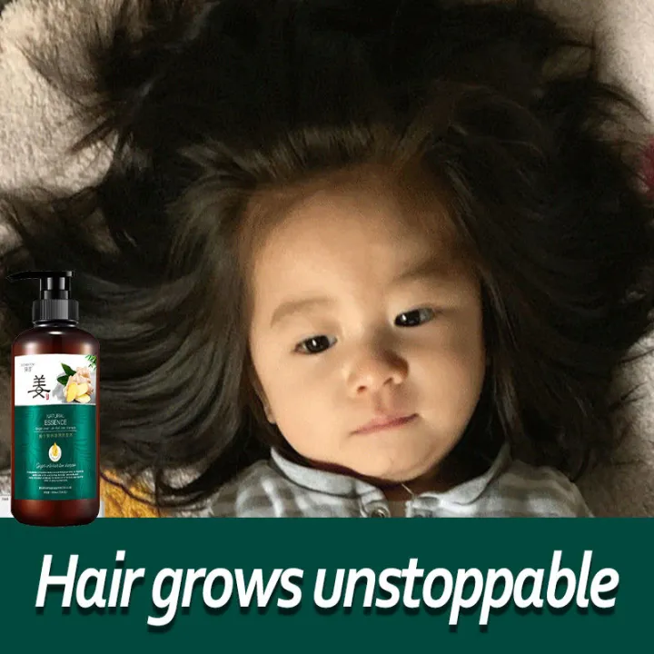 แชมพูลดผมร่วง แชมพูขิง ยับยั้งรังแค แชมพูลดผมร่วง ยาสระผมแก้ร่วง Hair