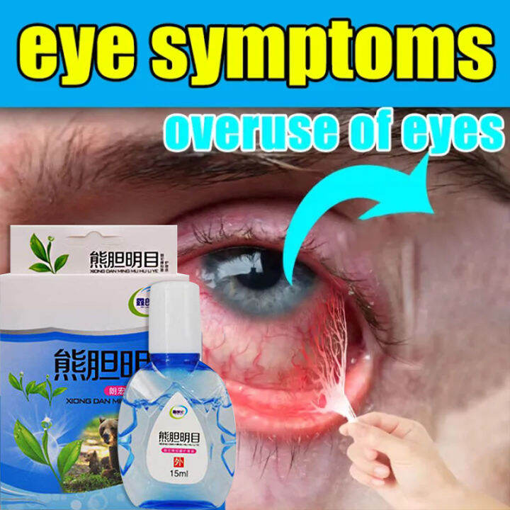 15ml original eye drops, dry eyes, bloodshot eyes, blurred eyes, red ...