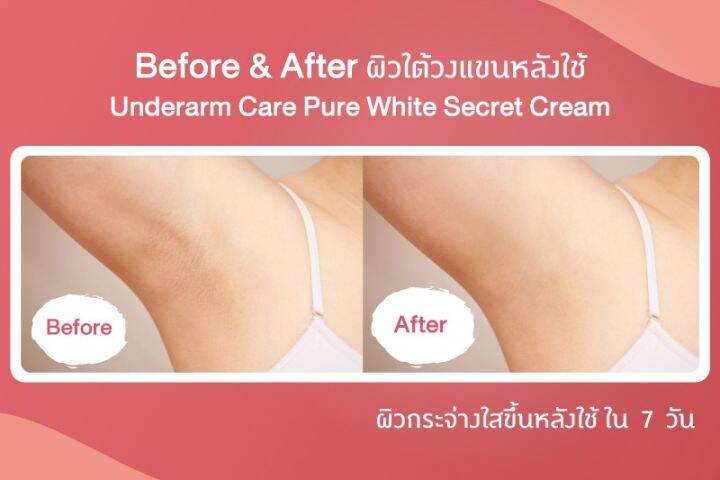 oriental-princess-underarm-care-pure-white-secret-toning-essence-ผลิตภัณฑ์สำหรับผิวใต้วงแขน