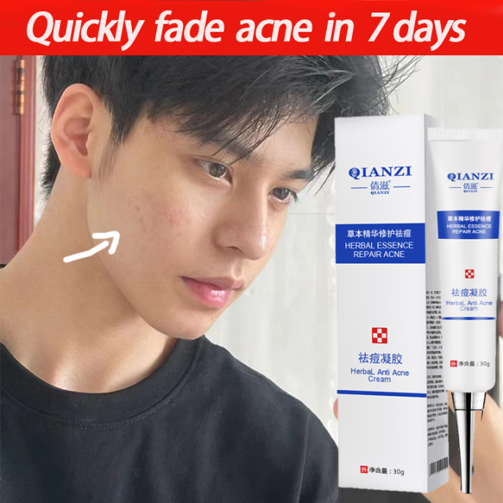Effective acne removing herbal essence repair acne removing cream 30g