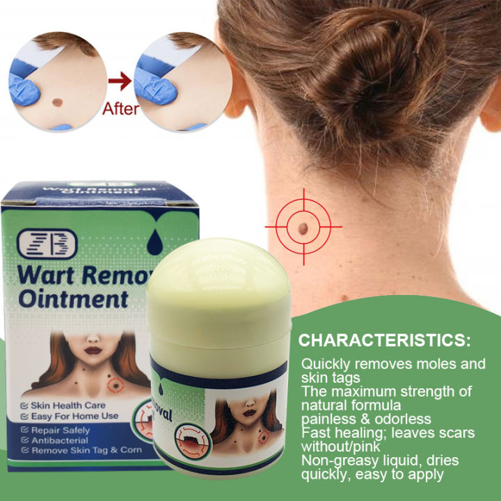 Original ZB Wart Removal Ointment Pain Relief Cream Treatment Skin Tag ...