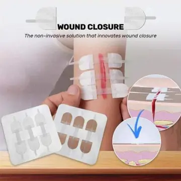 Buy Reduce Zipper Type Band Aid online