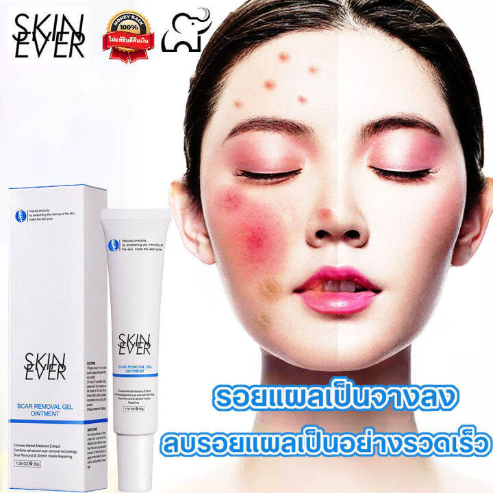 silky-intact-skin-ever-cream-remove-scar-cream-moisten-scar-formula-safe-denigrate-denigrate-skin-scar-repair-scar-from-mosquito-bite-รอยแผล-is-herbal-slimming-cream-repair